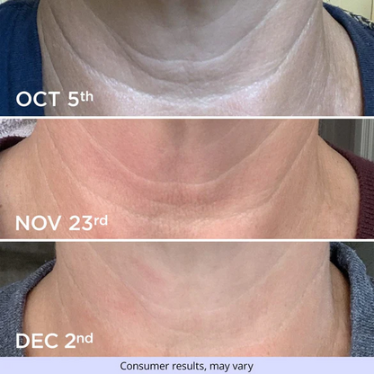 Cvreoz® Official Store Tighten & Glow Moisturizer Lifts, Firms, and Restores Radiance