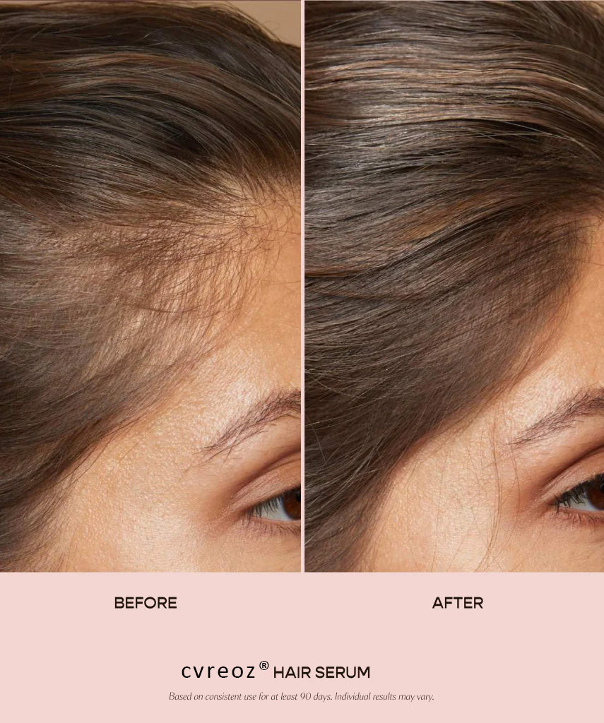 cvreoz Hair Serum