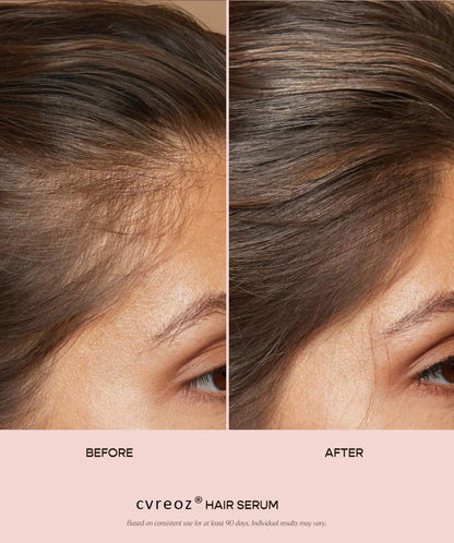 cvreoz Hair Serum