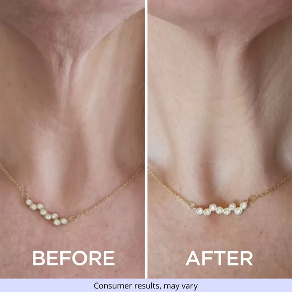Cvreoz® Official Store Tighten & Glow Moisturizer Lifts, Firms, and Restores Radiance