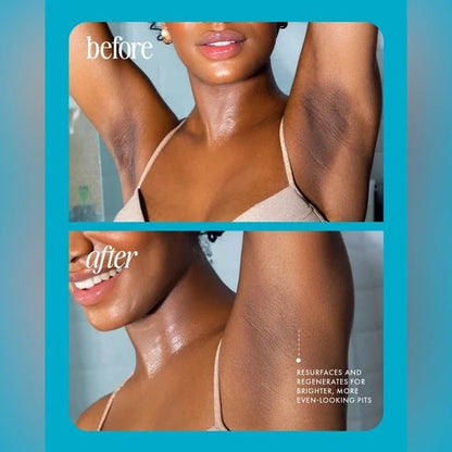 ⚡️ 5-Second Post-Hair Removal Rescue: Bumps Fade, Skin Glows! Glass Smooth Oil. 2